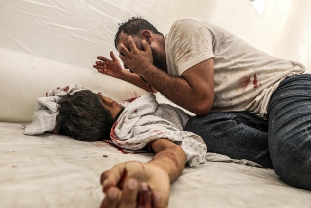 Gazze'de can kaybı 67 bin 806’ya yükseldi